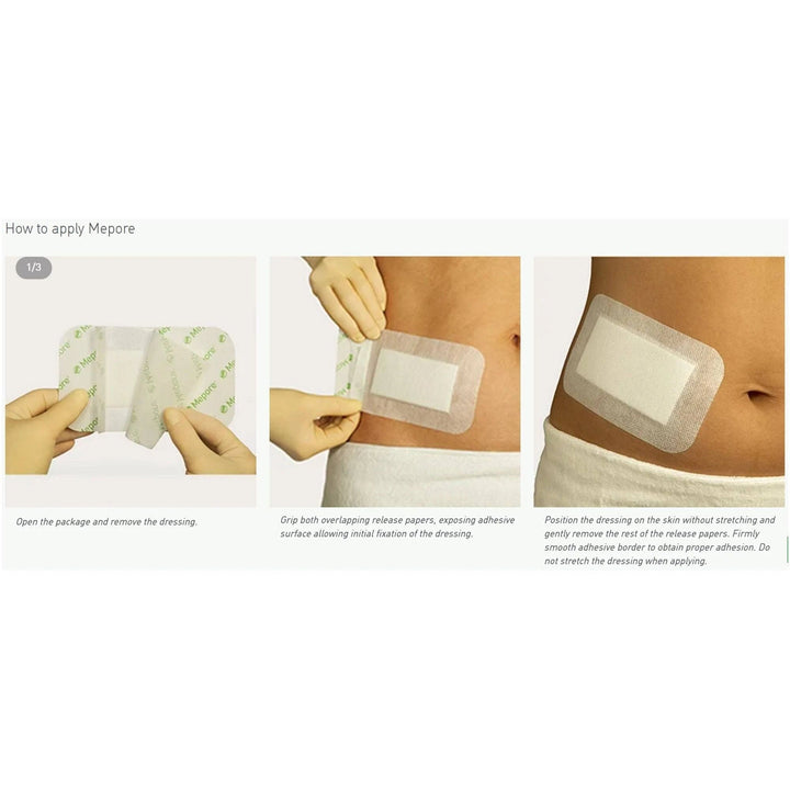 Mepore Dressing - 6cm x 7cm (60 pieces) First Aid