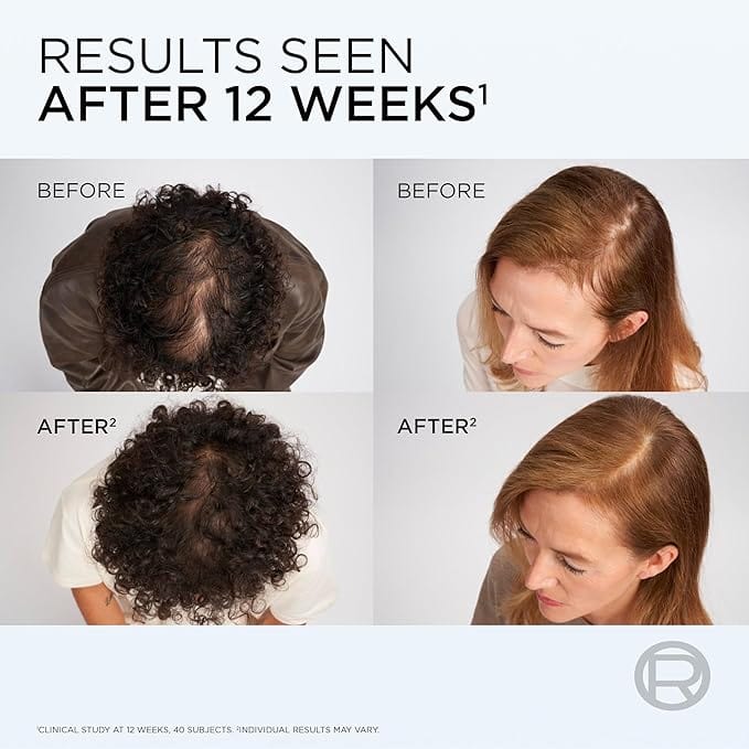 L'Oreal Elvive Hair Growth Booster Shampoo 200ml Haircare L'Oreal Elvive Hair Growth Booster Shampoo 200ml