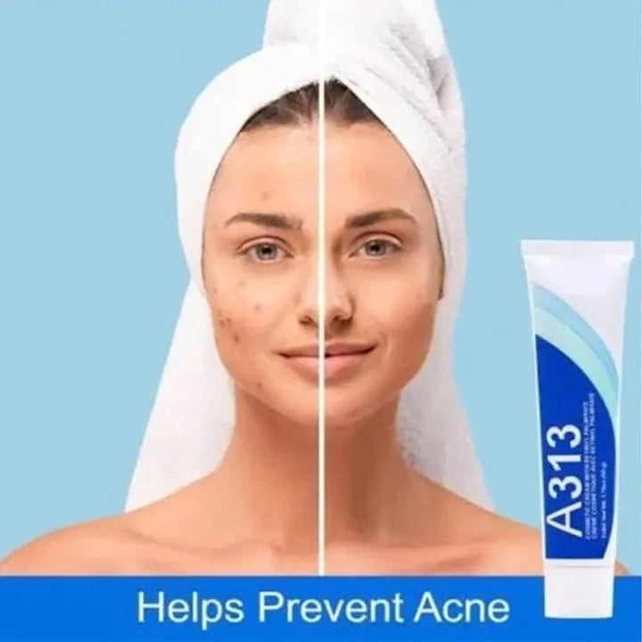 A313 Retinol Cream 50g SKIN CARE A313 Retinol Cream 50g