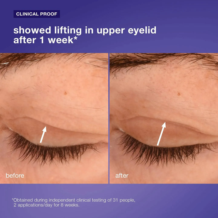 Dermalogica Phyto Nature Lift Eye Cream 15ml Skin Care Dermalogica Phyto Nature Lift Eye Cream 15ml