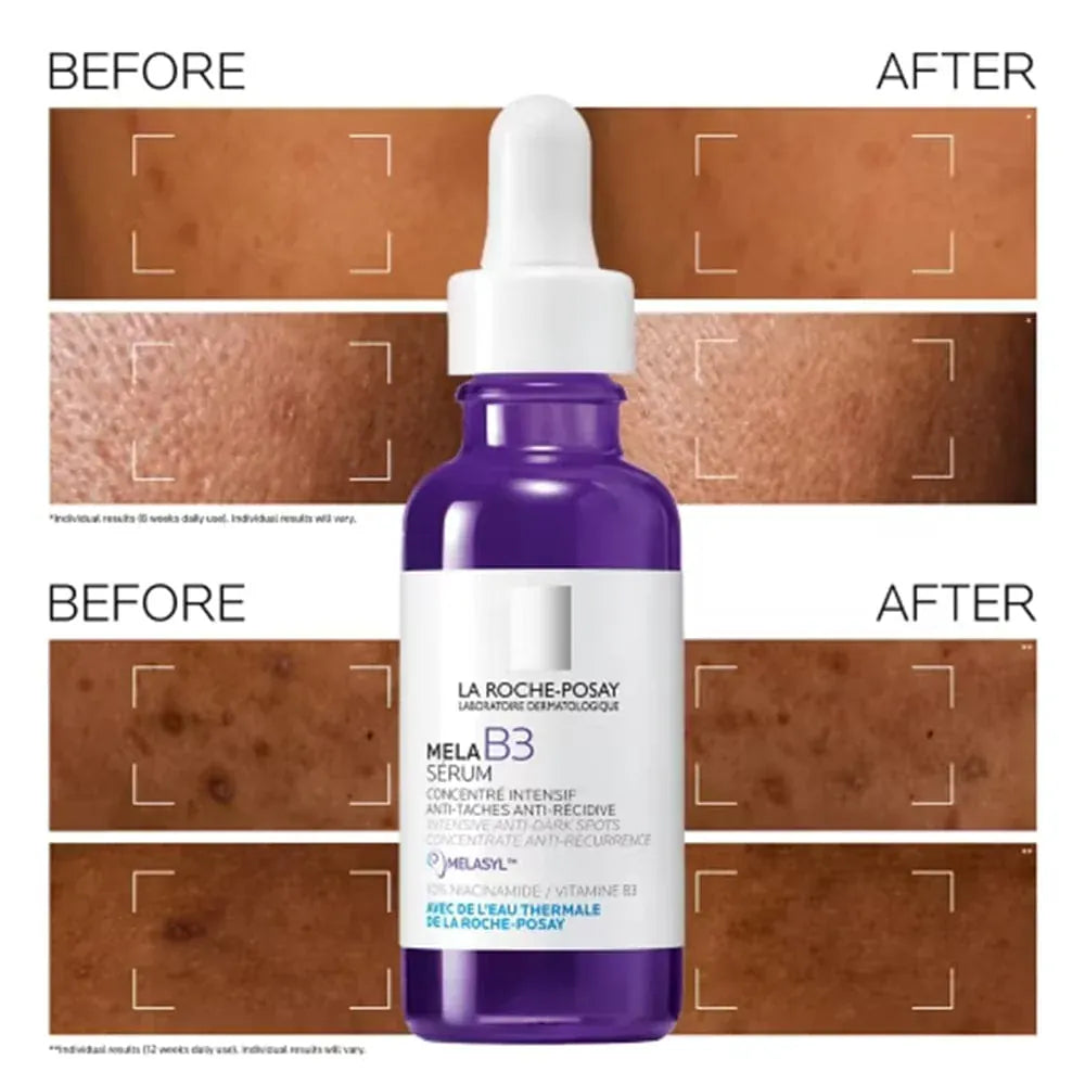La Roche-Posay Mela B3 Anti-Dark Spot Serum Skin Care La Roche-Posay Mela B3 Anti-Dark Spot Serum 30ml | Lir Pharmacy