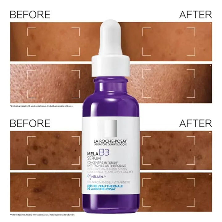 La Roche-Posay Mela B3 Anti-Dark Spot Serum Skin Care La Roche-Posay Mela B3 Anti-Dark Spot Serum 30ml | Lir Pharmacy